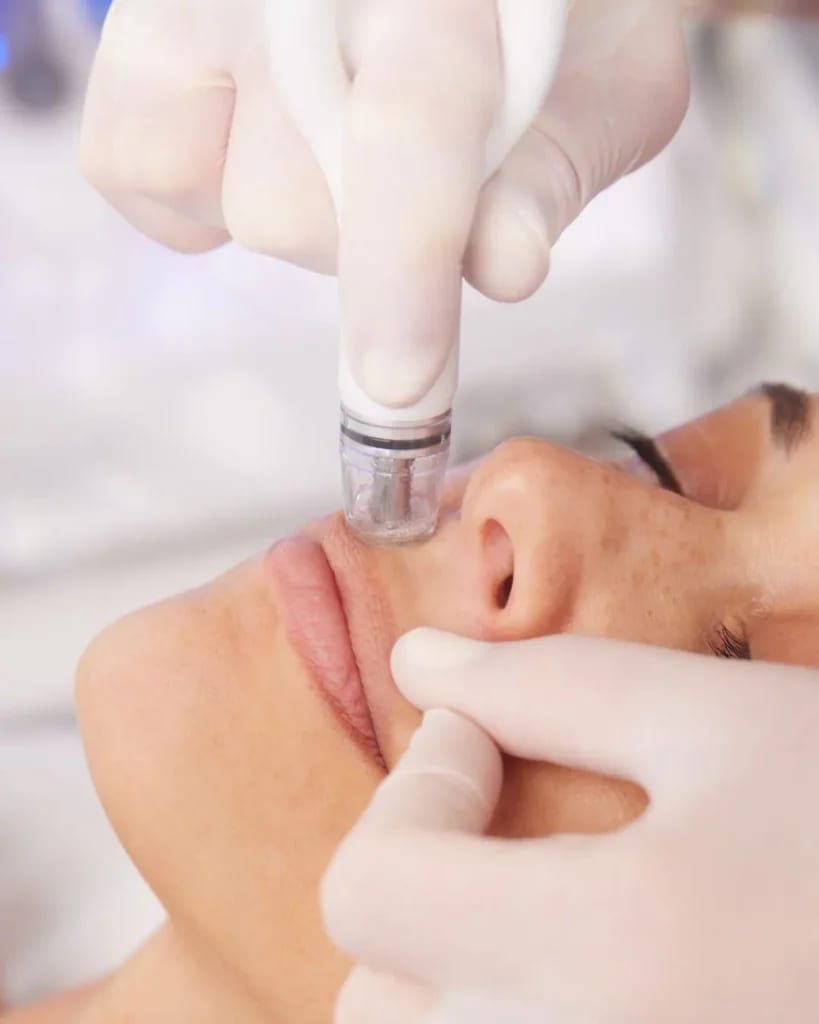 Photograph of a model: a DiamondGlow facial wand passes over a patient's cheek