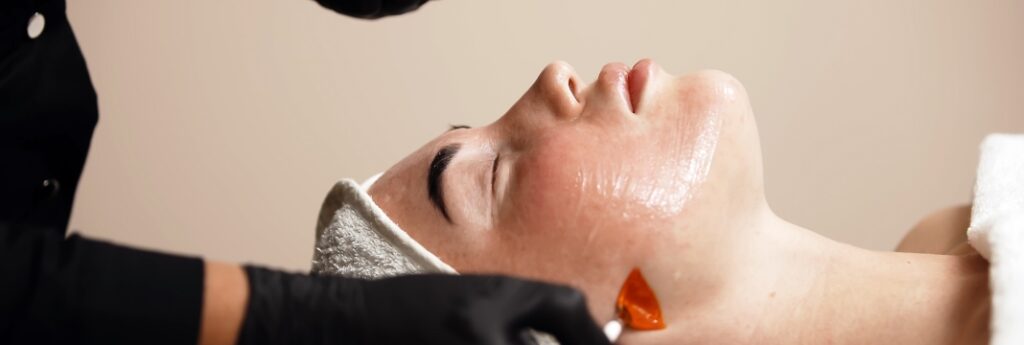 Photograph of a model: a woman lies back with a glistening chemical peel on her face while a gloved hand works near her jaw