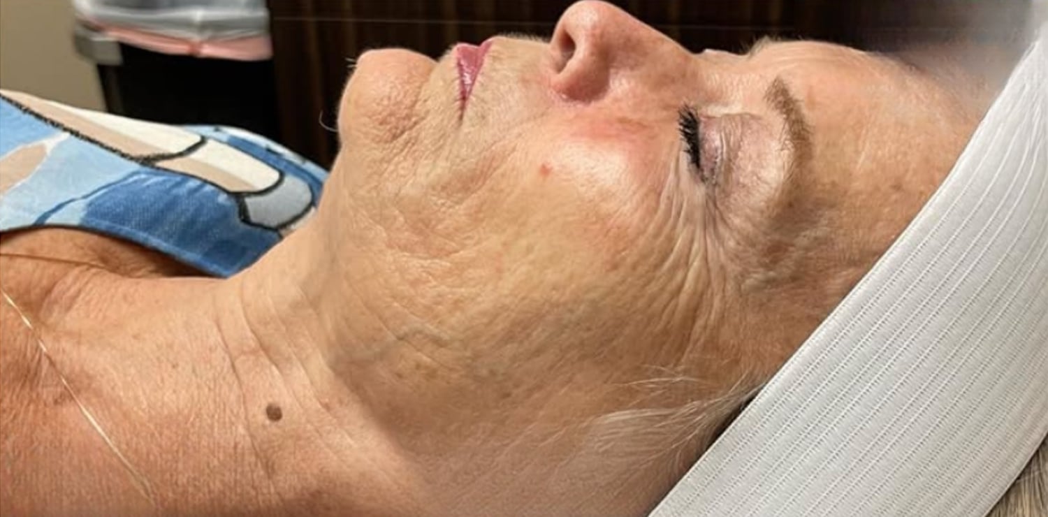 Before DiamondGlow: a woman reclining in profile with a white headband, her skin dull with fine lines