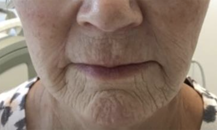 Before Image: Pixel - front