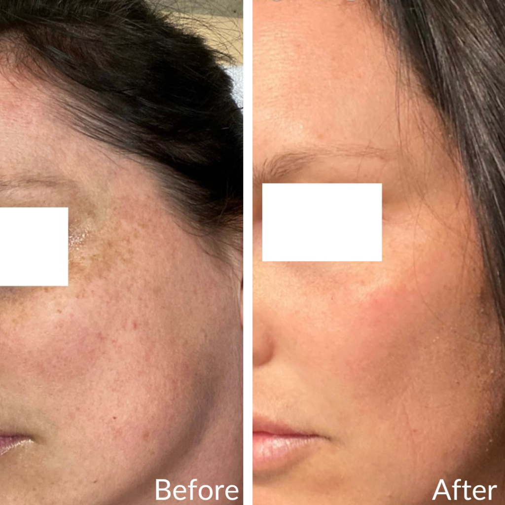 Before and After Image: Pixel - left-front-oblique